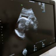 Dlaczego warto zapisać się na badanie prenatalne?